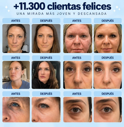 Zentrix | Contorno de Ojos Vitamina B5
